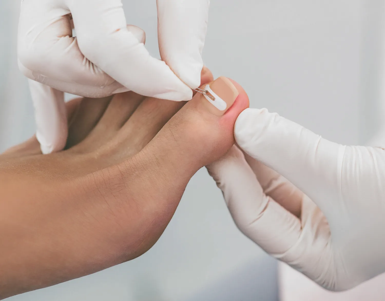 Pedicure leczniczy – co o nim wiedzieć warto?