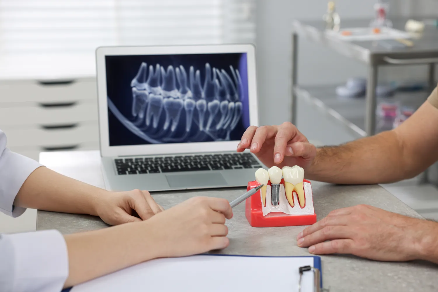 Rodzaje implantów zębowych